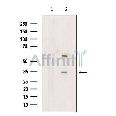 GJB3 Antibody - Western blot analysis of extracts from Rat  liver, using GJB3  Antibody.