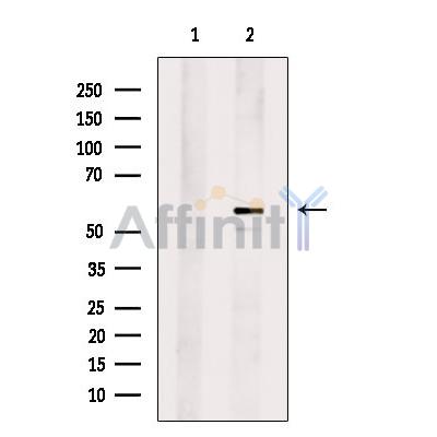 SLC1A4 Antibody - Western blot analysis of extracts from DU145 cells, using SLC1A4 Antibody.