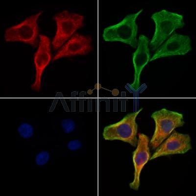 SSTR2 Antibody - DF7206 staining Hela cells by IF/ICC.
