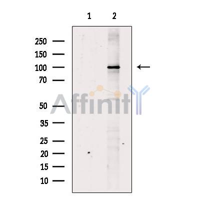 FAM160B2 Antibody - Western blot analysis of extracts from MDA-MB-231 cells, using FAM160B2 Antibody.