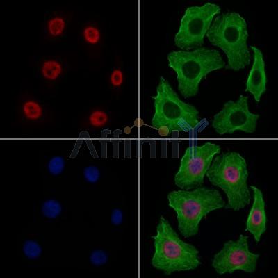 Nono Antibody - DF7254 staining Hela cells by IF/ICC.