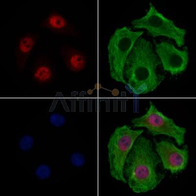 SMARCE1 Antibody - DF7301 staining Hela cells by IF/ICC.