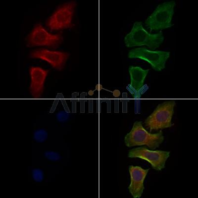 GDI1 Antibody - DF7352 staining Hela cells by IF/ICC.