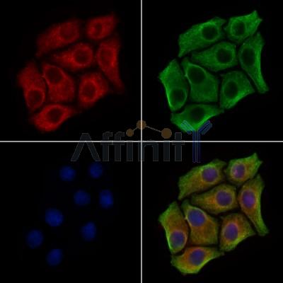 prouty 4 Antibody - DF7509 staining HepG2 cells by IF/ICC.