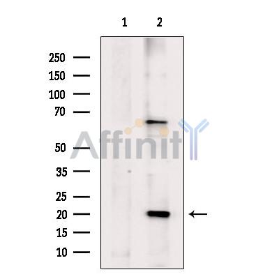 MYCB Antibody - Western blot analysis of extracts from P19 cells, using MYCB Antibody.