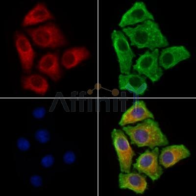 MAG Antibody - DF7669 staining HepG2 cells by IF/ICC.