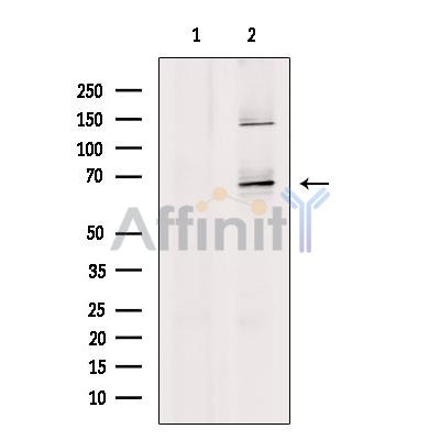 MMP21 Antibody - Western blot analysis of extracts from Hela cells, using MMP21 Antibody.