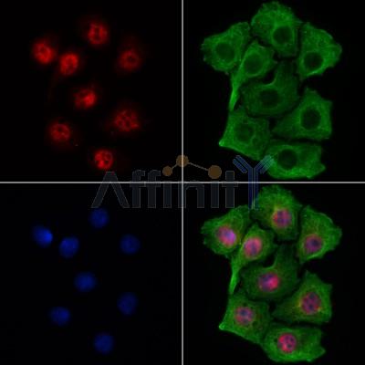GLIS3 Antibody - DF7749 staining HepG2 cells by IF/ICC.