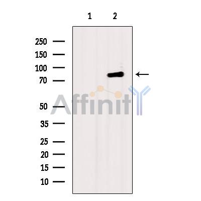 DAB2 Antibody - Western blot analysis of extracts from HepG2 cells, using DAB2 Antibody.
