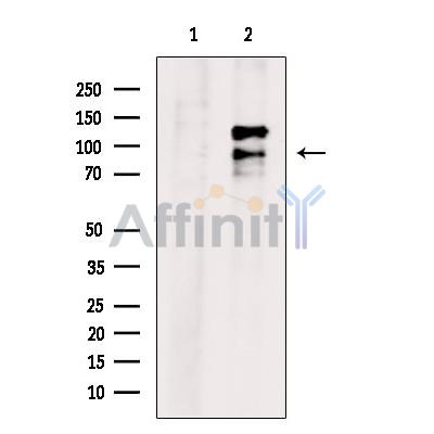 HNRNPUL1 Antibody - Western blot analysis of extracts from C6 cells, using HNRNPUL1 Antibody.