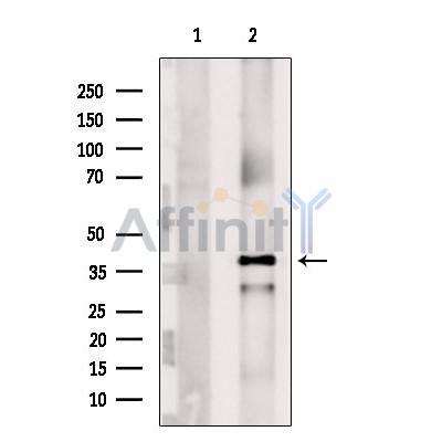 NDUFAF1 Antibody - Western blot analysis of extracts from Rat  lung, using NDUFAF1 Antibody.