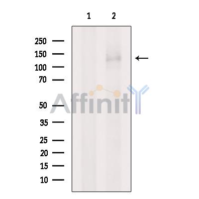 PUM1 Antibody - Western blot analysis of extracts from 3T3, using PUM1 Antibody.