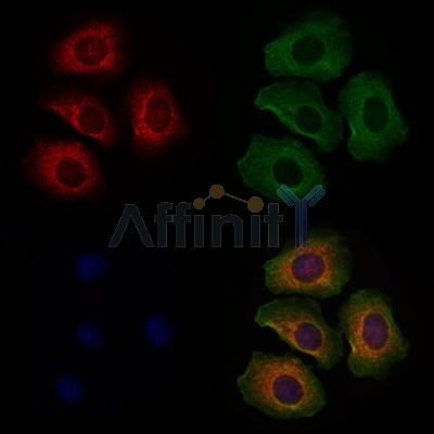 EYA2 Antibody - DF7909 staining Hela cells by IF/ICC.