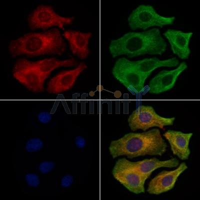 BCAM Antibody - DF8041 staining Hela cells by IF/ICC.
