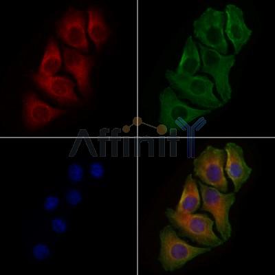 CDK5R2 Antibody - DF8204 staining Hela cells by IF/ICC.
