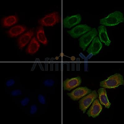 Defensin beta-2 Antibody - DF8531 staining Hela cells by IF/ICC.