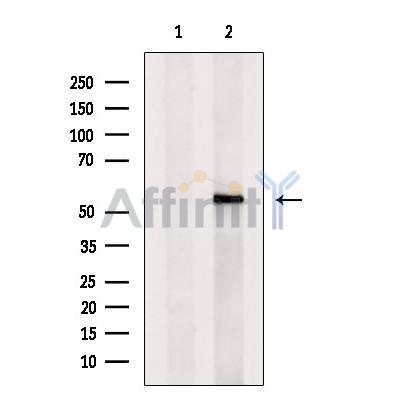 Pax-9 Antibody - Western blot analysis of extracts from MDA-MB-231 cells, using Pax-9 Antibody.