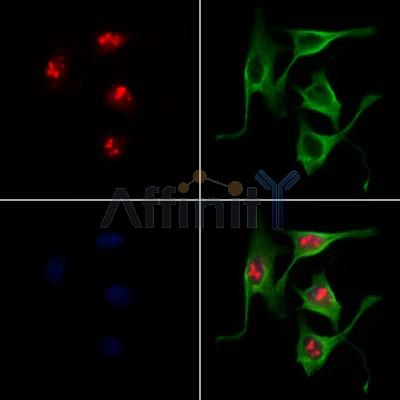 SOX11 Antibody - DF8614 staining 3T3 by IF/ICC.