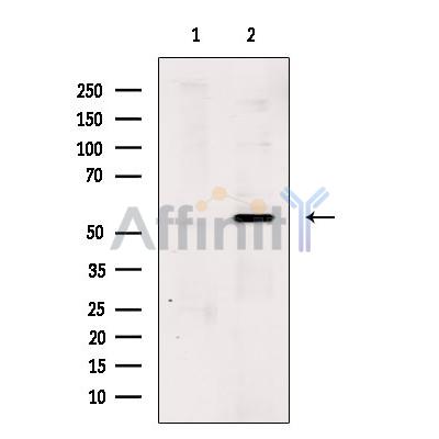SOX11 Antibody - Western blot analysis of extracts from Hela cells, using Sox-11 Antibody.