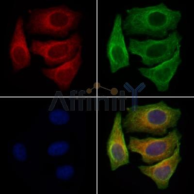 AWAT1 Antibody - DF8640 staining Hela cells by IF/ICC.