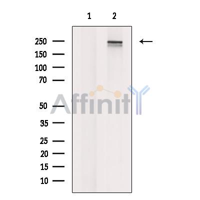 ARI1A Antibody - Western blot analysis of extracts from DU145 cells, using ARI1A Antibody.