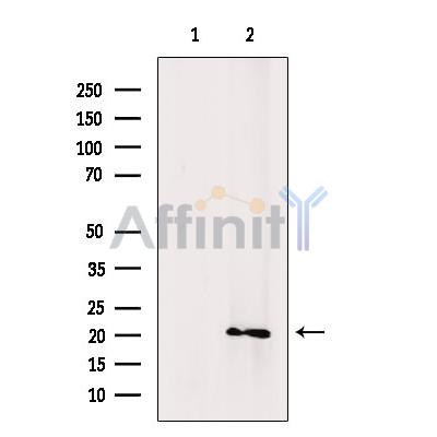 CD52 Antibody - Western blot analysis of extracts from VERO cells, using CD52 Antibody.