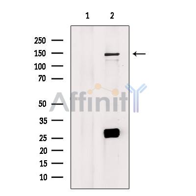 MAP3K15 Antibody - Western blot analysis of extracts from B16F10 cells, using MAP3K15 Antibody.