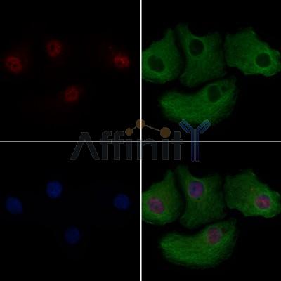 ZNF496 Antibody - DF8859 staining Hela cells by IF/ICC.