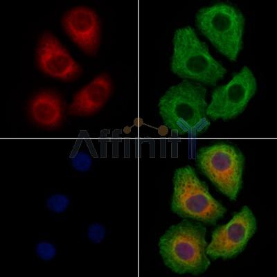 DNAJA1 Antibody - DF8940 staining Hela cells by IF/ICC.