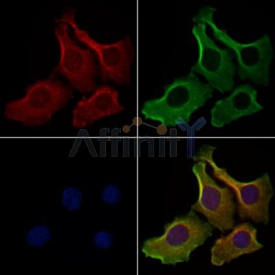 IL17F Antibody - DF8981 staining Hela cells by IF/ICC.