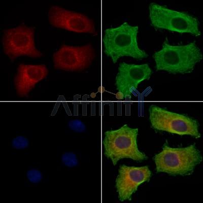 IL31 Antibody - DF8986 staining Hela cells by IF/ICC.