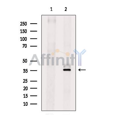 IL31 Antibody - Western blot analysis of extracts from Mouse  kidney, using IL31 Antibody.