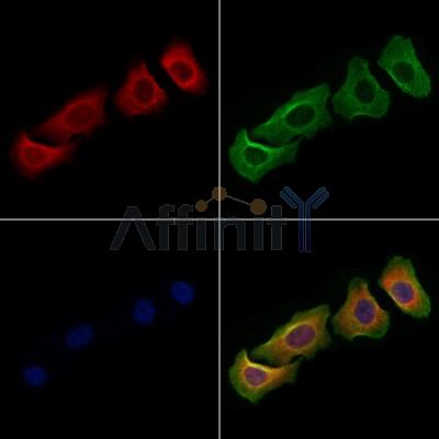 ACBD5 Antibody - DF9152 staining Hela cells by IF/ICC.