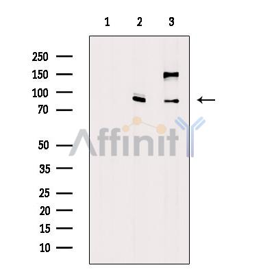 ADAM28 Antibody - Western blot analysis of extracts from various samples, using ADAM28 Antibody.