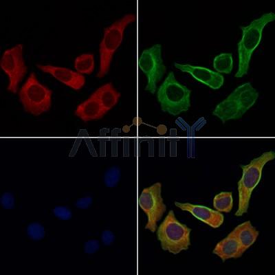 ADAMTS9 Antibody - DF9178 staining Hela cells by IF/ICC.