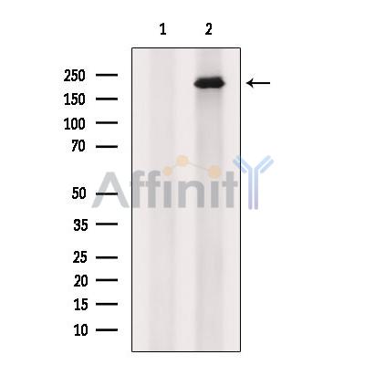 ALMS1 Antibody - Western blot analysis of extracts from Huvec, using ALMS1 Antibody.