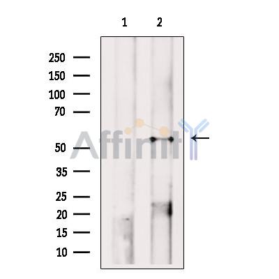 FOX1 Antibody - Western blot analysis of extracts from Rat  lung, using FOX1 Antibody.