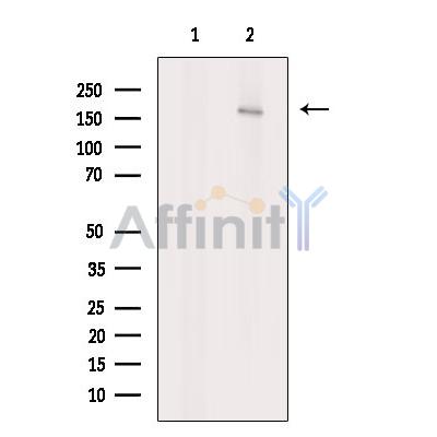 ABCA5 Antibody - Western blot analysis of extracts from MCF7, using ABCA5 Antibody.