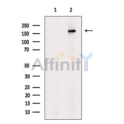 ABCA9 Antibody - Western blot analysis of extracts from Rat  lung, using ABCA9 Antibody.