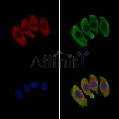 ABCC9 Antibody - DF9255 staining Hela cells by IF/ICC.
