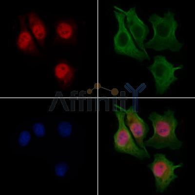RECQL4 Antibody - DF9257 staining Hela cells by IF/ICC.