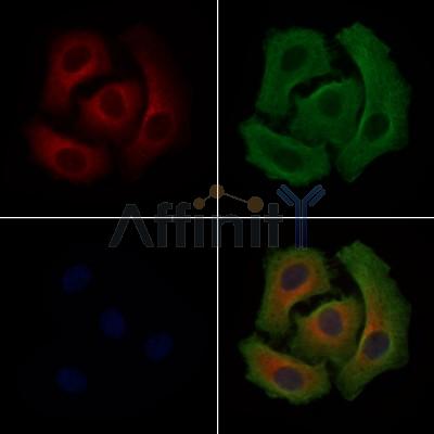 SLC25A13 Antibody - DF9303 staining Hela cells by IF/ICC.