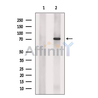 SLC25A13 Antibody - Western blot analysis of extracts from DU145 cells, using SLC25A13 Antibody.