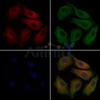 CABP4 Antibody - DF9308 staining Hela cells by IF/ICC.