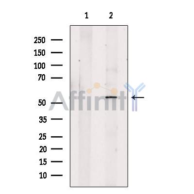 CABYR Antibody - Western blot analysis of extracts from C6 cells, using CABYR Antibody.
