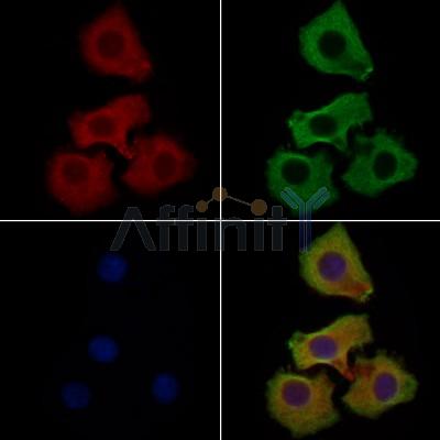 CAPN6 Antibody - DF9321 staining Hela cells by IF/ICC.