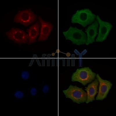 CNN3 Antibody - DF9323 staining Hela cells by IF/ICC.