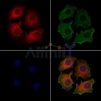 CHST14 Antibody - DF9331 staining Hela cells by IF/ICC.