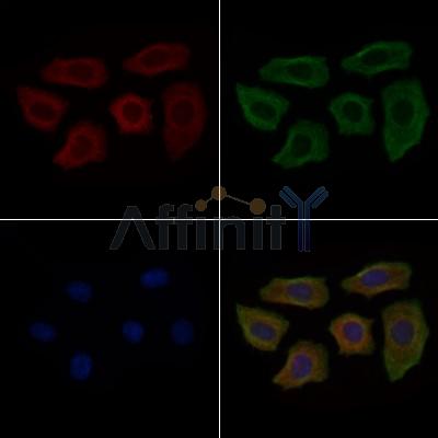 CPD Antibody - DF9339 staining Hela cells by IF/ICC.