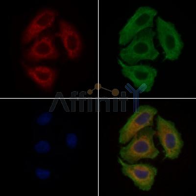 CATSPER3 Antibody - DF9350 staining Hela cells by IF/ICC.